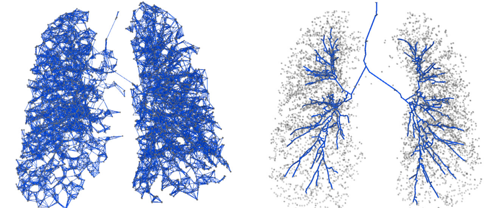 Medical Image Analysis